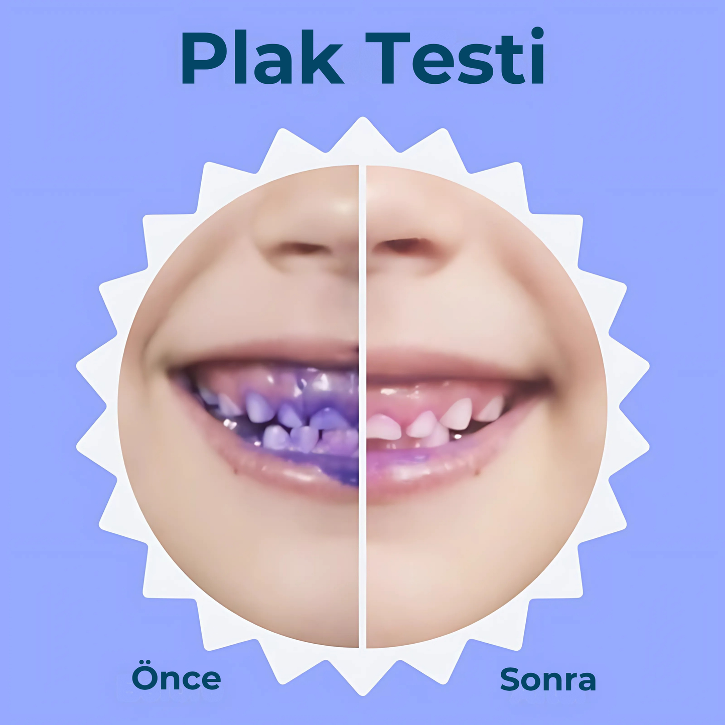Prosmile Kids